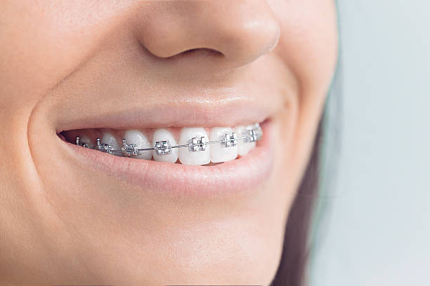 Why Choose Us for Your Dental Needs in Mission Hills, CA